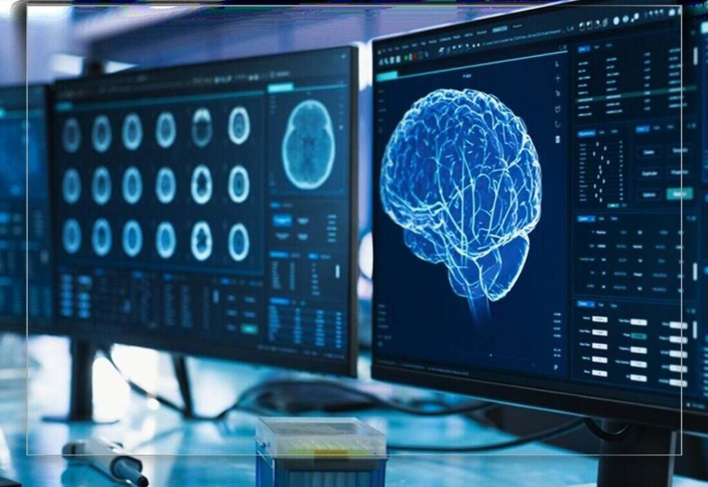 average settlement for traumatic brain injury